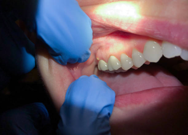 Best Emergency Denture Repair in Rockmart, GA