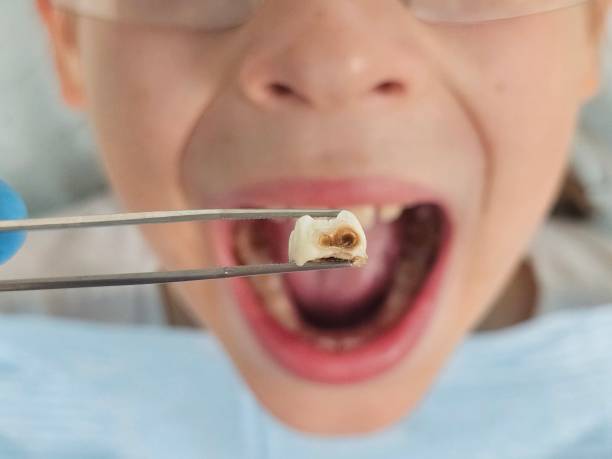 Best Same-Day Emergency Dental Services in Rockmart, GA